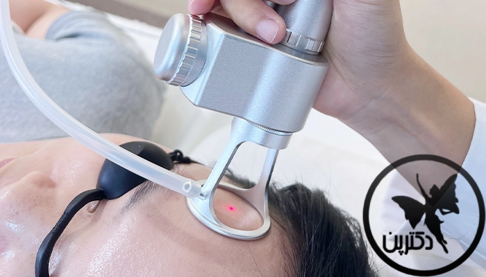 لیزر پوست تکنولوژی و پیچیدگی‌ها