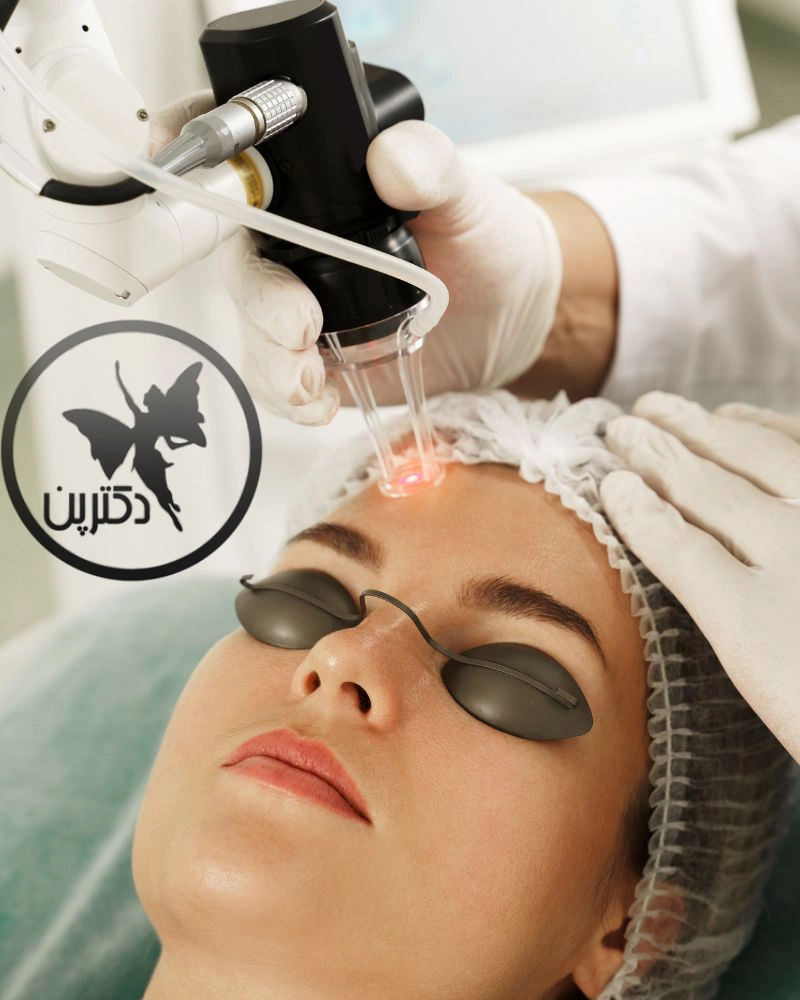 لیزرهای-ابلاتیو-(Ablative)-چیست؟