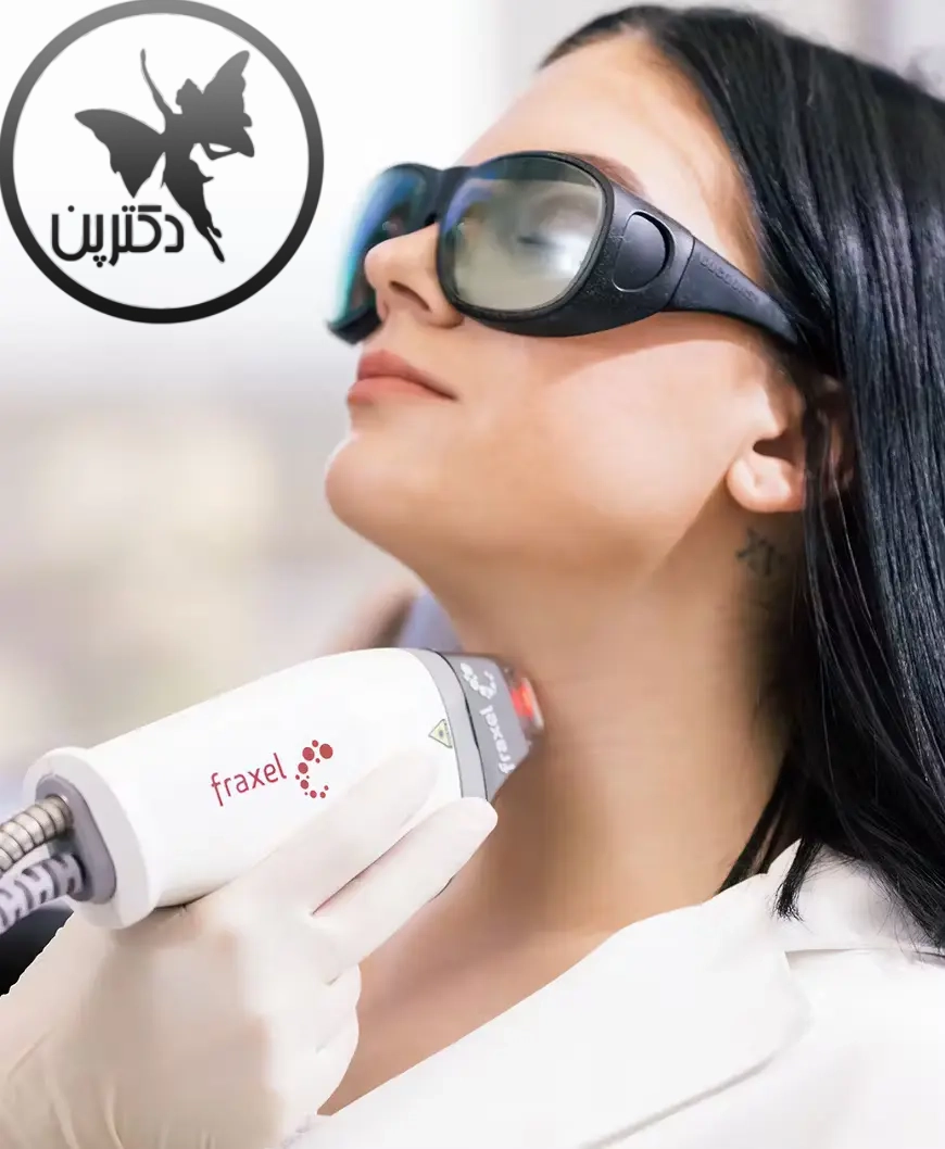 لیزرهای-غیرابلاتیو-(Non-Ablative)-چیست؟