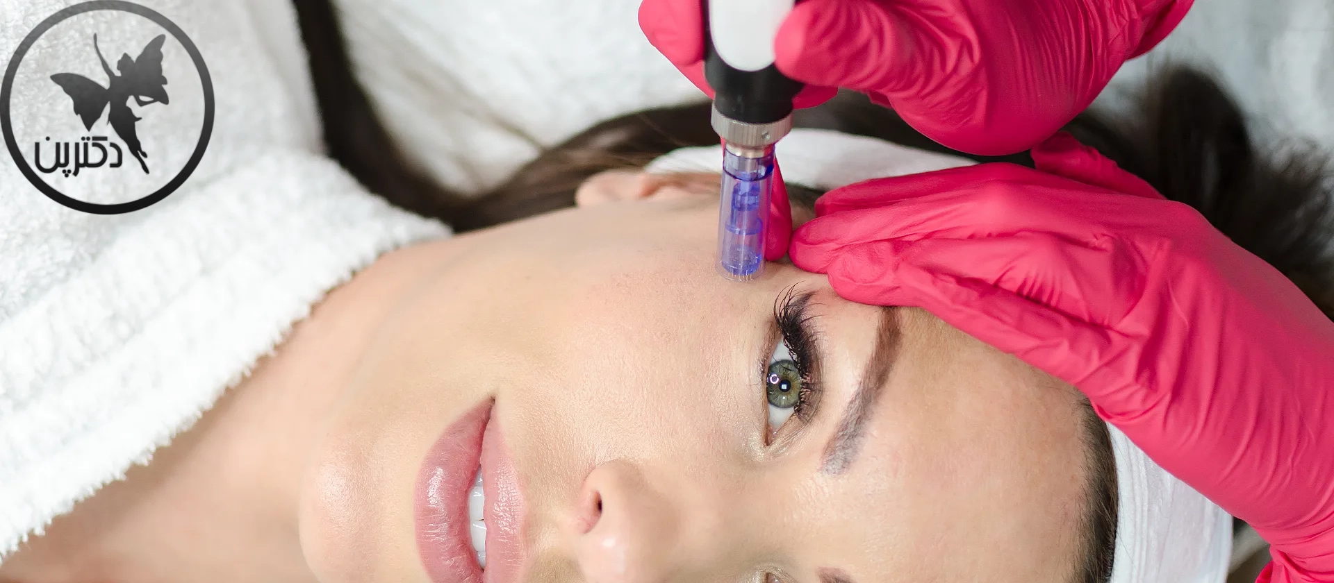 میکرونیدلینگ برقی (درماپن) چیست؟