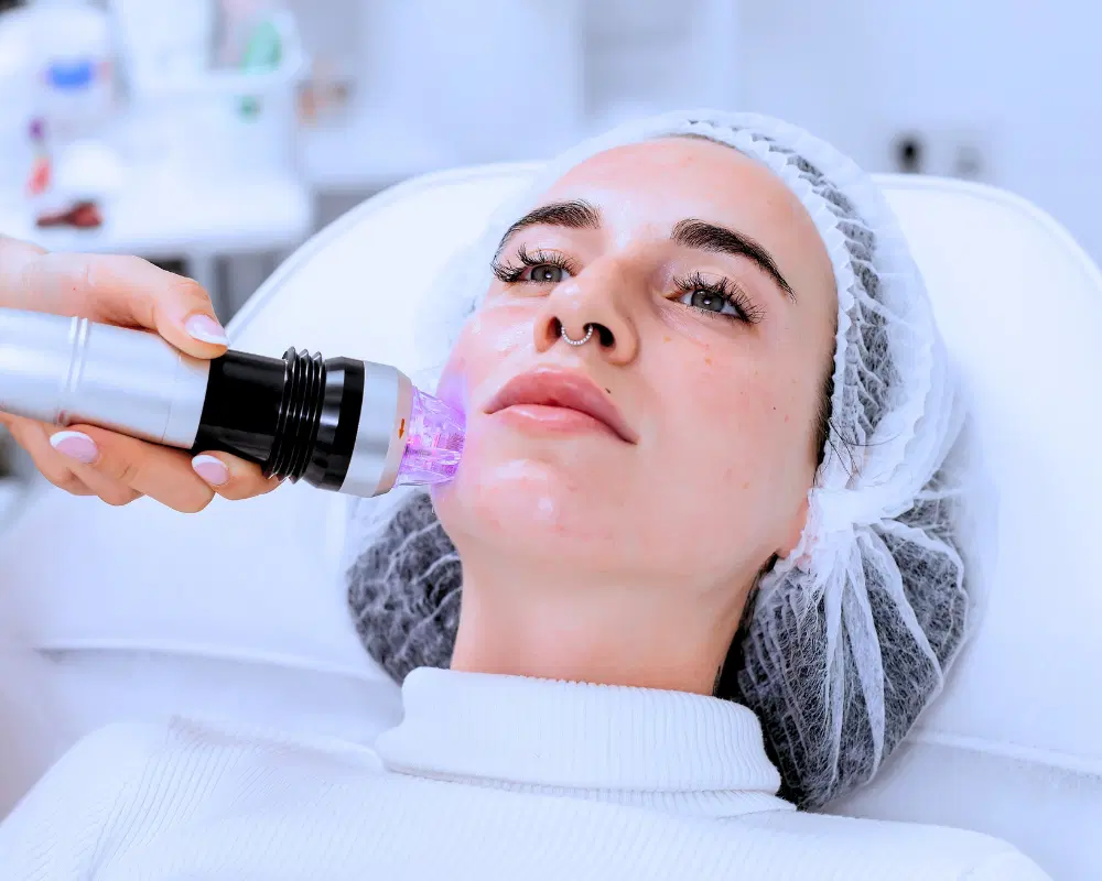 میکرونیدلینگ فرکانسی RF Microneedling چیست؟